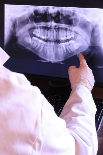 Best Emergency Treatment for Toothache in Gholson, TX